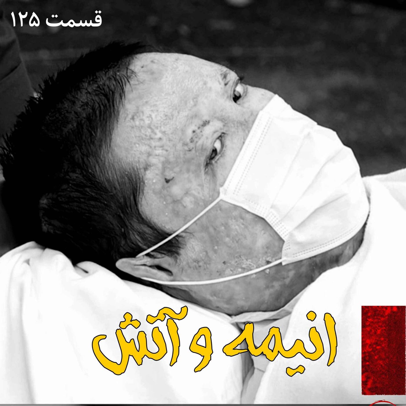 انیمه و آتش episode artwork
